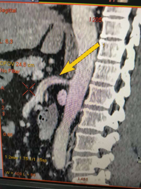 1644308843788491.png image.png